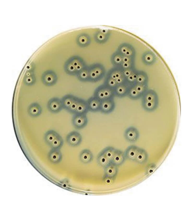 Yema de Huevo- Telurita en Emulsion 50 ml