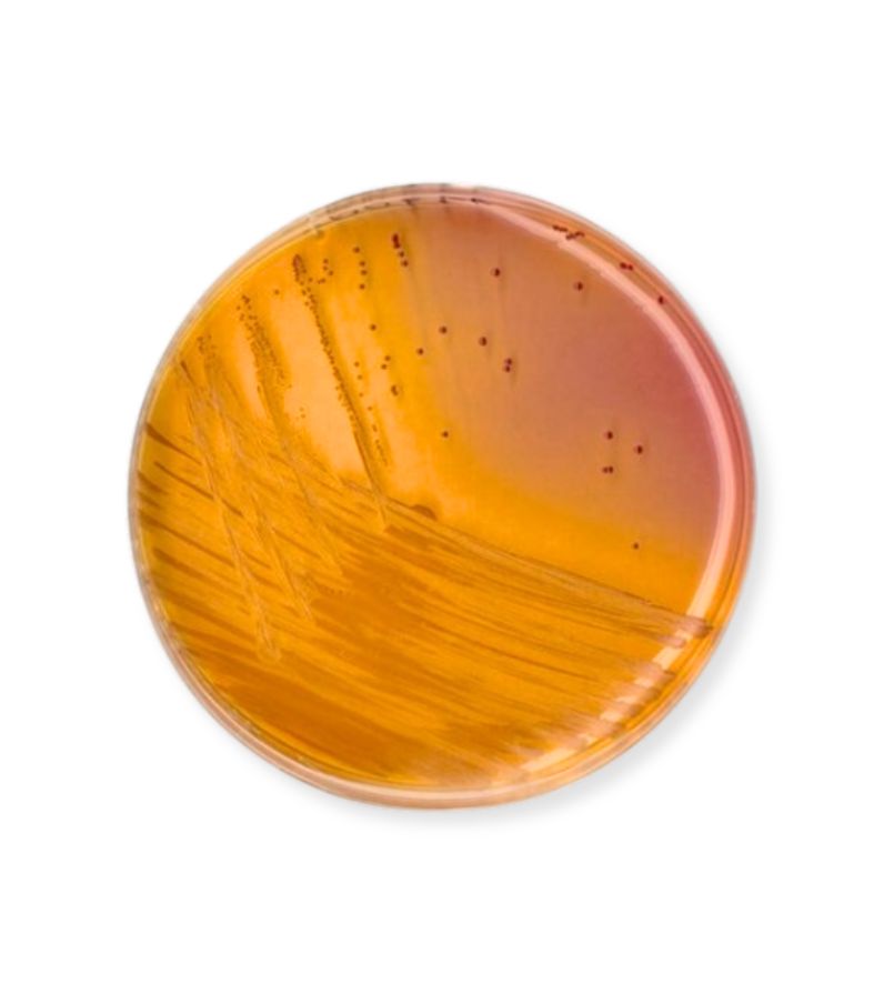 Agar KF para Estreptococos para Microbiología NutriSelect™ plus 500 gr